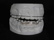 Laboratorio Dental - trabajo-detalle-1