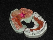 Laboratorio Dental - trabajo-detalle-5