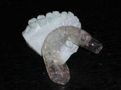 Férula dental