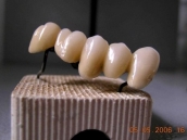 Laboratorio Dental - trabajo-detalles-2
