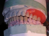 Laboratorio Dental - trabajo-detalles-3