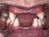 Laboratorio Dental - trabajo-muestra-8